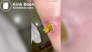 Japanese Twitter College Girl Very Very Big Poop