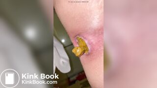 Japanese Twitter College Girl Very Very Big Poop