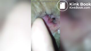 Close Up Inside Womens Asshole