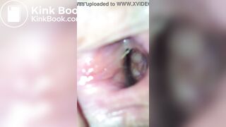 Close Up Inside Womens Asshole