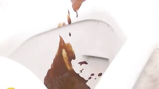 Smooth diarrhea