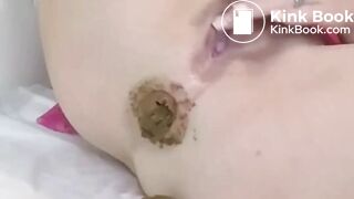 axelA