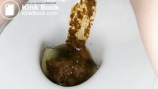 Another ex frontview toilet poop 10