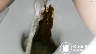 Another ex frontview toilet poop 10