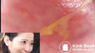 pooping - video 592