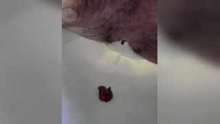 prune diarrhea - video 2