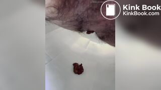 prune diarrhea - video 2