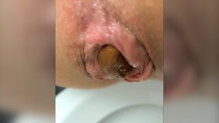 Empty your bowels for me please