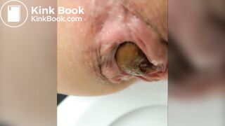 Empty your bowels for me please