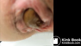 Empty your bowels for me please