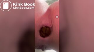 Constipation - video 12