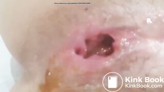 Scat 492