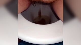 woman shows us her poop