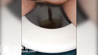 woman shows us her poop