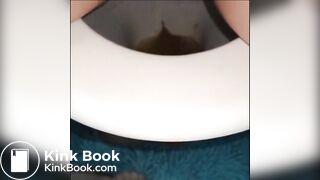 woman shows us her poop