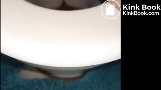 woman shows us her poop