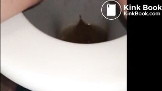 woman shows us her poop