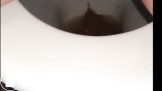 woman shows us her poop