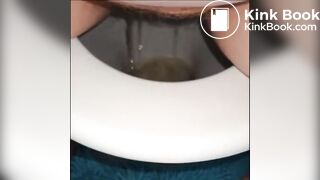 woman shows us her poop