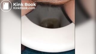 woman shows us her poop