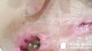 CHINESE GIRL POOPING - video 2