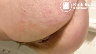 Diarrhea toilet - video 10