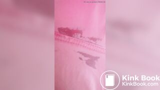 Marshmallow diarrhea eruption