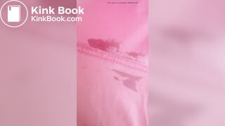 Marshmallow diarrhea eruption