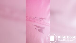 Marshmallow diarrhea eruption