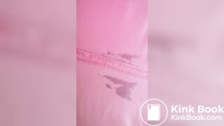 Marshmallow diarrhea eruption