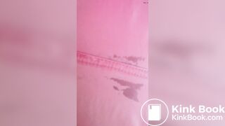 Marshmallow diarrhea eruption