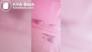 Marshmallow diarrhea eruption