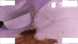 doctor makes sure you used that diaper