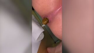 Japanese Monster turd 1