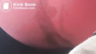 Bubbly diarrhea mush