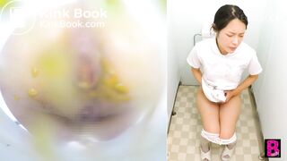 Old toilet cam (after enema)