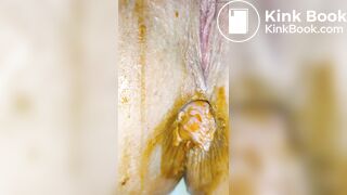 Prolapsing pussy with rosebud makes a mess