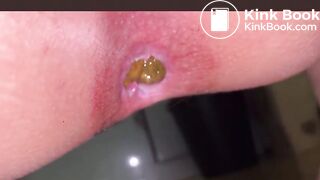 Japanese Girl constipated turd 2