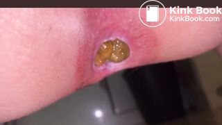 Japanese Girl constipated turd 2