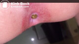 Japanese Girl constipated turd 2