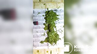 Hairy Ebony Asshole Scat Pooping Outdoor Part- 4