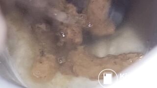 Girl Pooping & Farting Public