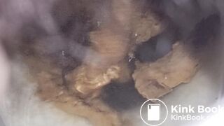 Girl Pooping & Farting Public