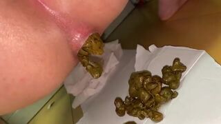 japanese girl poop - video 92