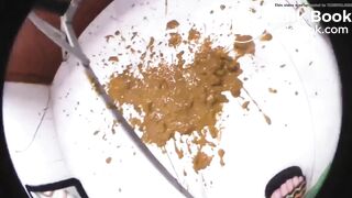 Juicy ass spewing liquid shit