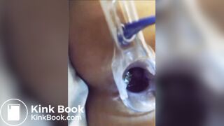 You can see her shit in her asshole?