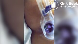 You can see her shit in her asshole?