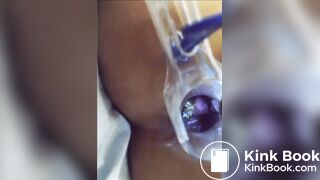 You can see her shit in her asshole?