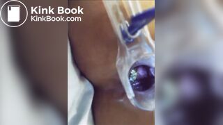 You can see her shit in her asshole?