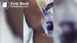 You can see her shit in her asshole?